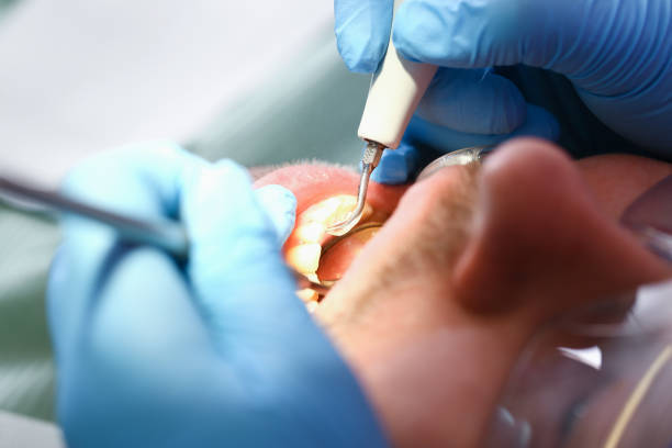 Best Emergency Gum Pain Relief  in Fort Scott, KS