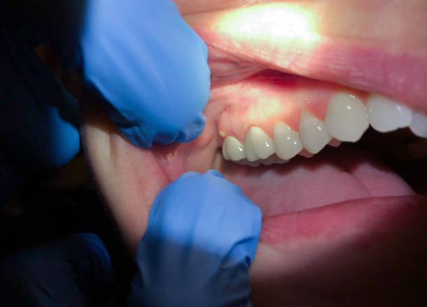 Best Emergency Dentist Near Me  in Fort Scott, KS