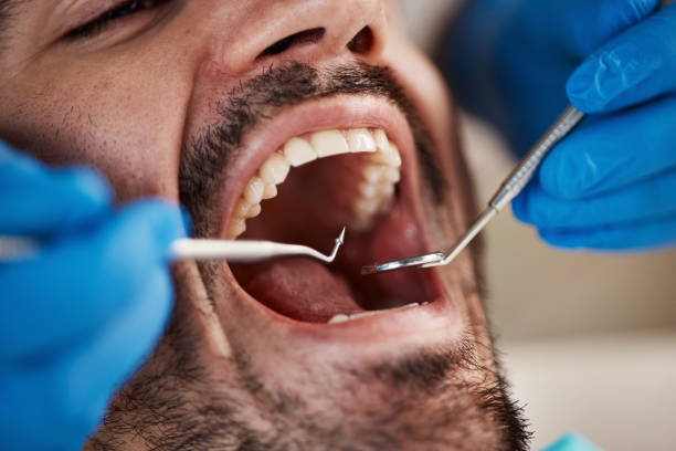 Best Affordable Emergency Dental Care  in Fort Scott, KS
